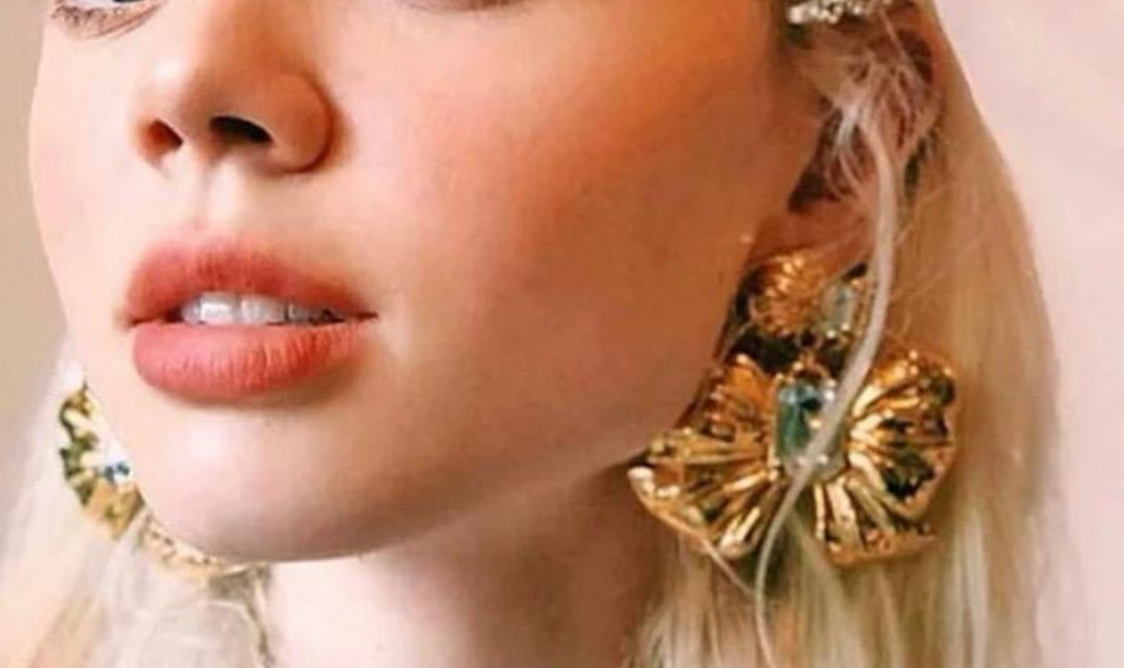 My Gold Bows
